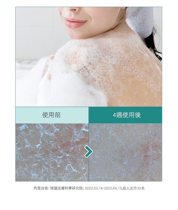 Physiogel潔美淨 層脂質水楊酸淨膚沐浴乳